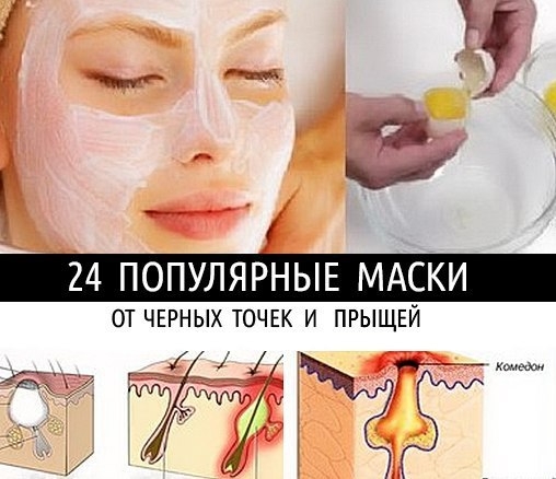 24 ПОПУЛЯРНЫЕ МАСКИ ОТ ЧЕРНЫХ ТОЧЕК И ПРЫЩЕЙ! 24 ПОПУЛЯРНЫЕ МАСКИ ОТ ЧЕРНЫХ ТОЧЕК И ПРЫЩЕЙ!