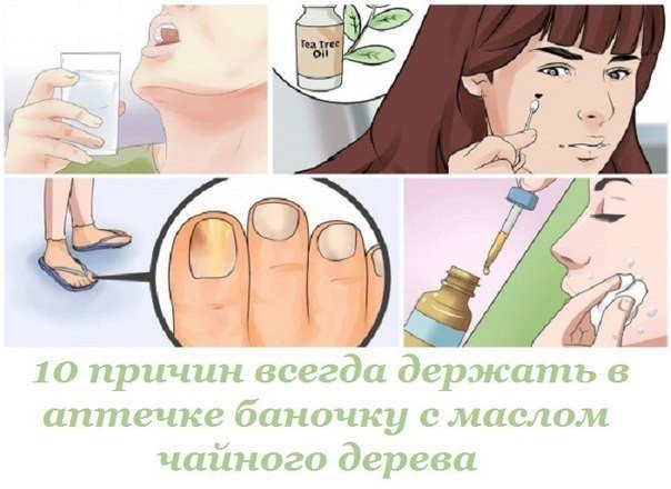 Масло чайного дерева имеет широкий спектр действия, оно обладает противовирусными, антибактериальным Масло чайного дерева имеет широкий спектр действия, оно обладает противовирусными, антибактериальным