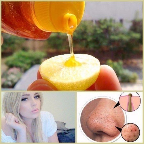 Лимонная маска от черных точек Лимонная маска от черных точек