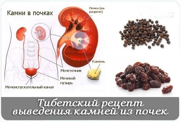 Тибетский рецепт выведения камней из почек – черный перец.