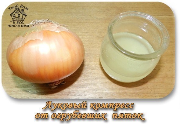 Луковый компресс от огрубевших пяток