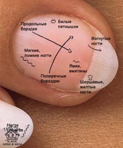 ЧТО ОЗНАЧАЮТ "МЕТКИ" НА НОГТЯХ