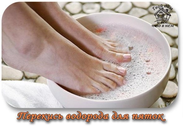 Перекись водорода ... для пяток Перекись водорода ... для пяток
