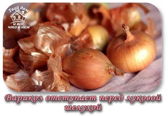 Варикоз отступает перед луковой шелухой Варикоз отступает перед луковой шелухой