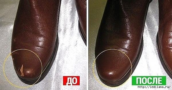 СКОРАЯ ПОМОЩЬ ОБУВИ